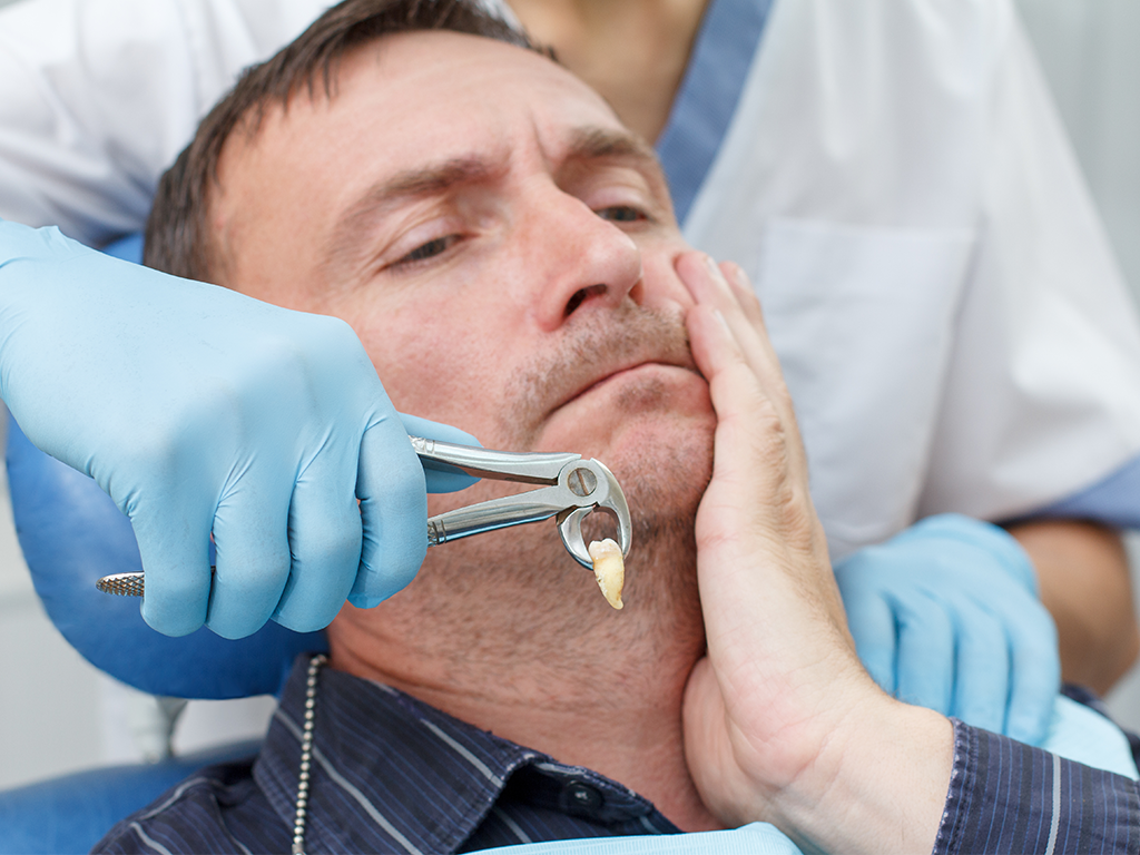 Tooth Extraction